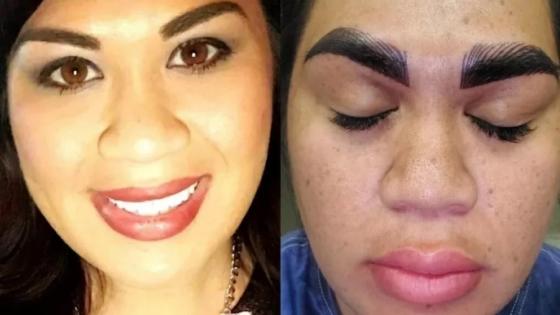 "Horripilante", diz mulher  após pagar  R$ 1,7 mil em procedimento para sobrancelhas  
